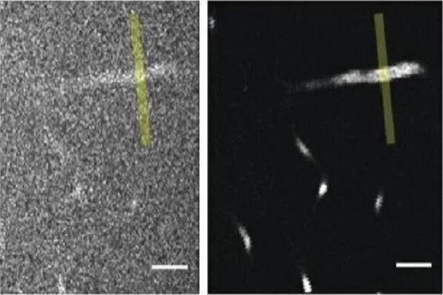 ثبت تصاویر دقیق از مغز با یک میکروسکوپ قوی